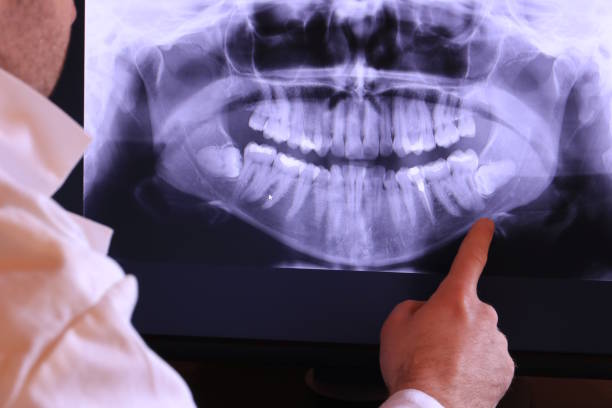Best Emergency Wisdom Teeth Removal in Rockwood, MI