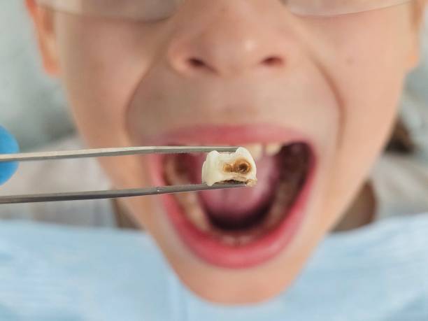 Best Emergency Treatment for Toothache in Rockwood, MI